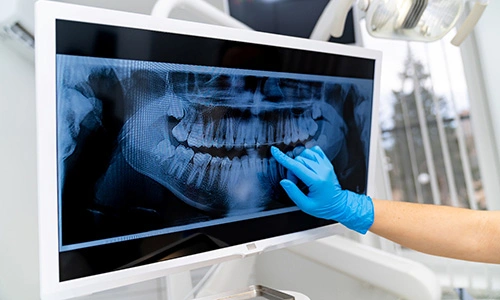 a dentist pointing at an X-ray
