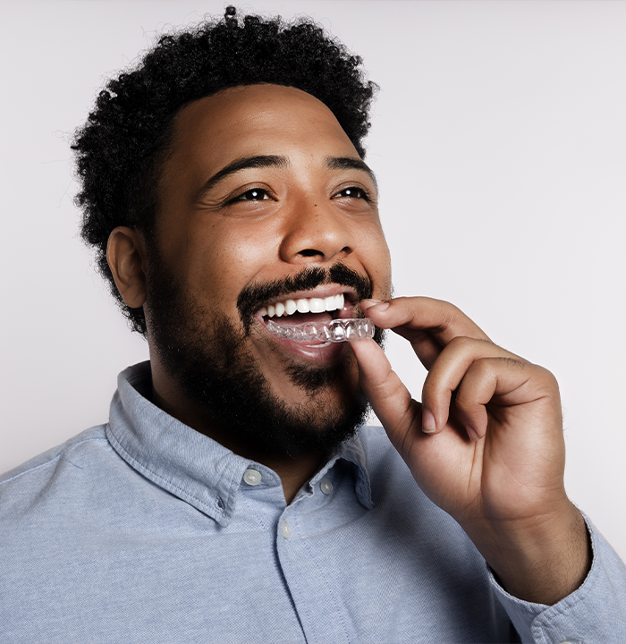 Man placing a clear aligner over his teeth