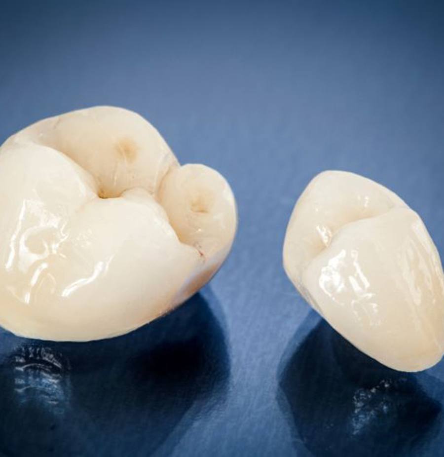 Two dental crowns on reflective surface