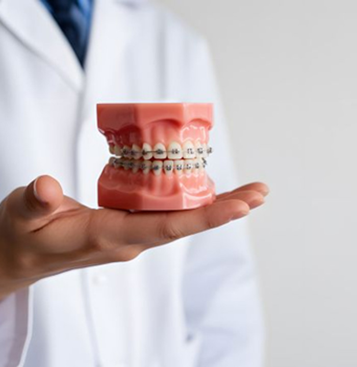 Dentist holding tooth model with braces
