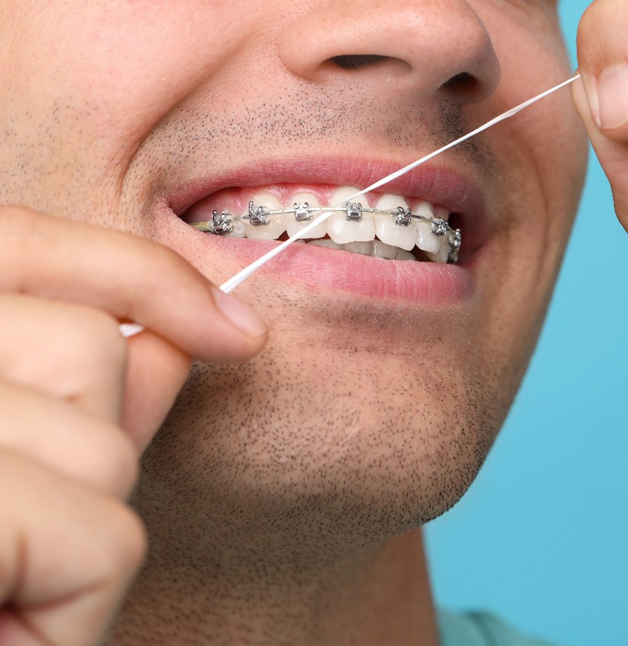 Man with braces flossing his teeth