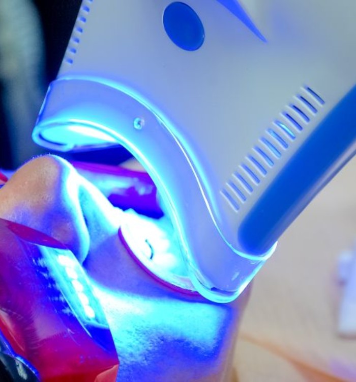 Patient relaxing during in-office whitening treatment