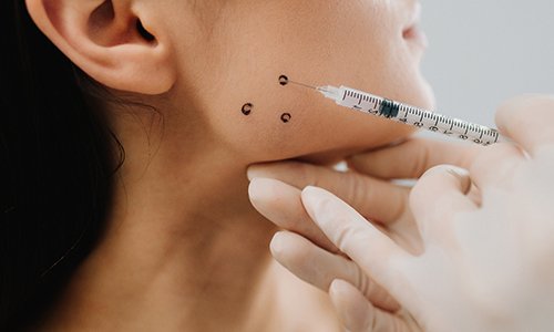 Woman receiving injections near her jaw